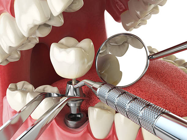 Best Weekend Emergency Dentist in Riceville, TN