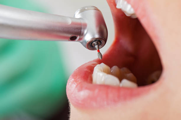 Best Emergency Dental Surgery in Riceville, TN